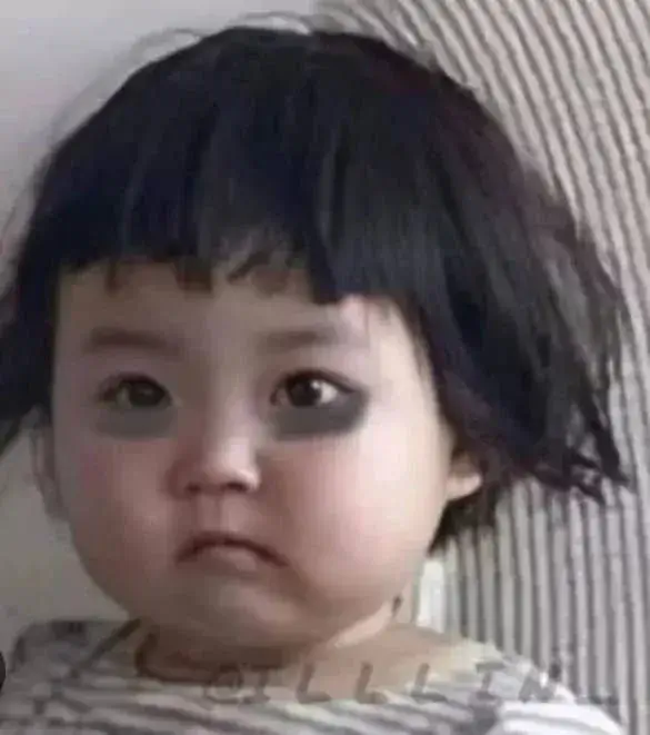 Gương mặt bé gái héo hon với vòng đen sâu hoắm