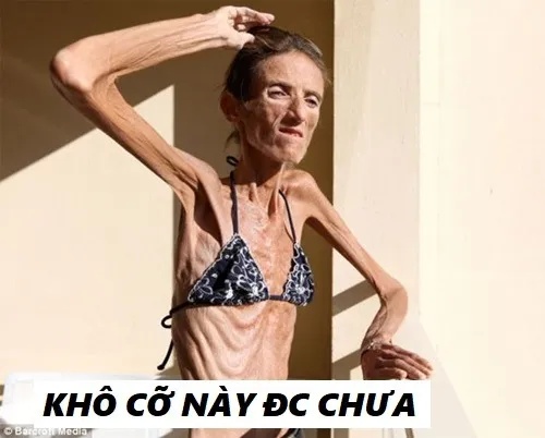 Meme Vắt Cực Khô